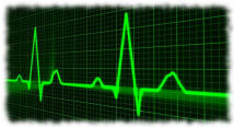 medicale defibrillatore